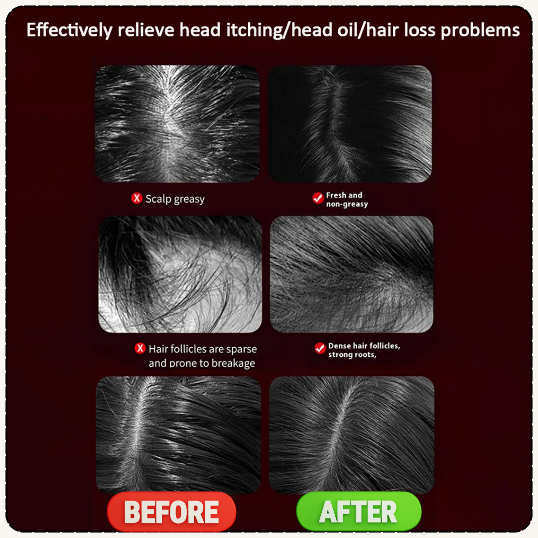 Hair Growth Scalp Massage Comb